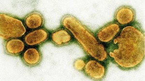 A tragédia da Gripe Espanhola deu início às primeiras iniciativas globais de combate a epidemias
